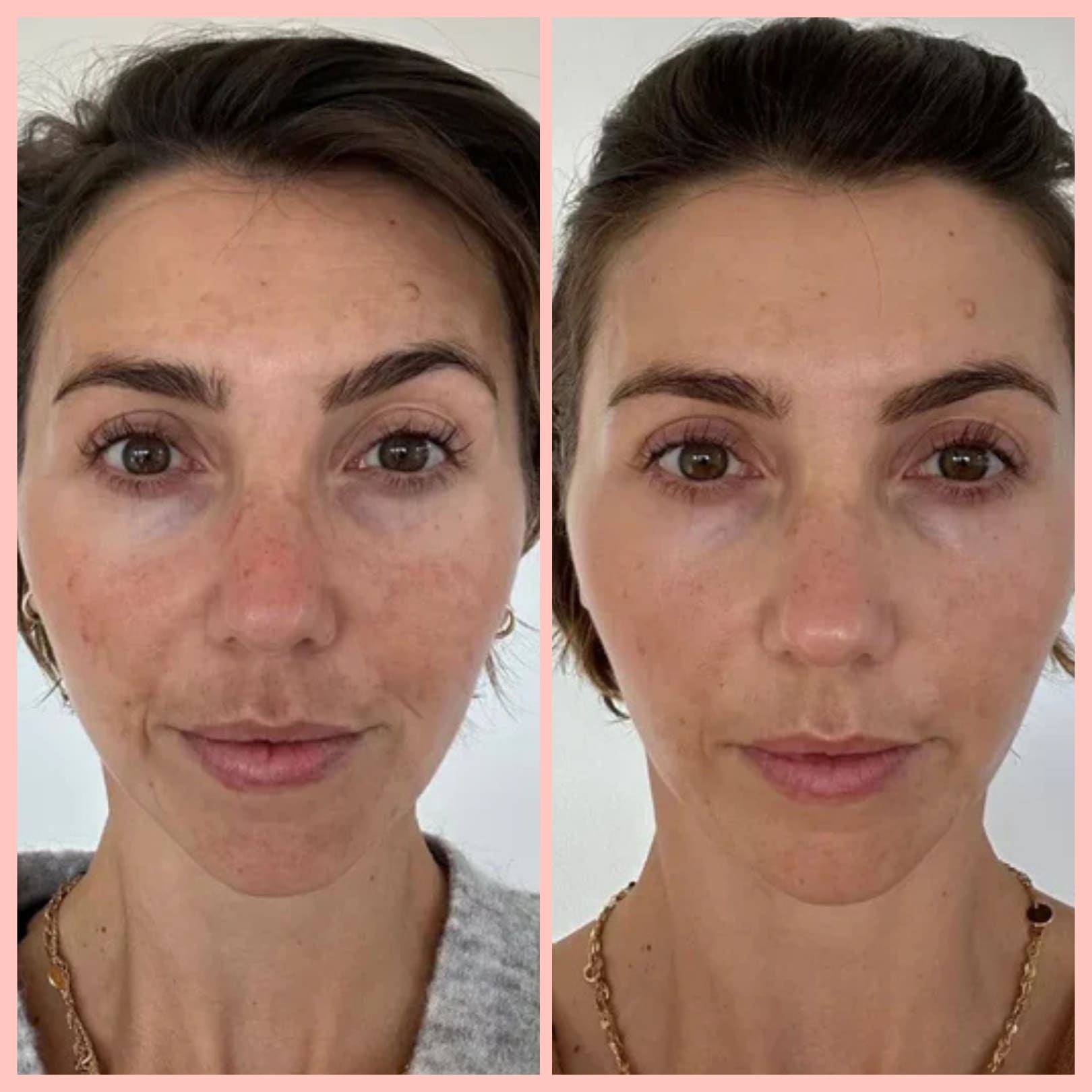 MIRAE GLOW – Masque de nuit au collagène