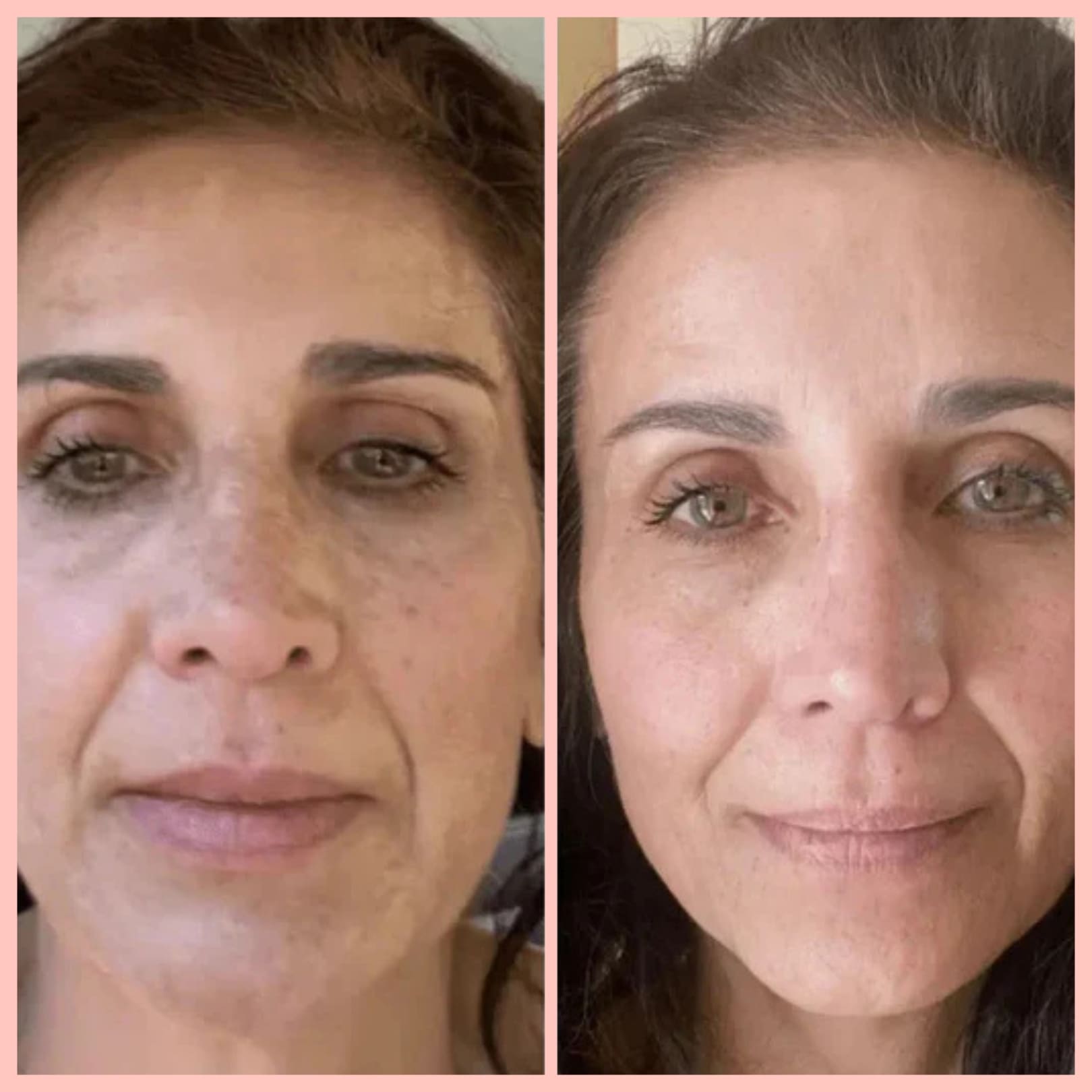 MIRAE GLOW – Masque de nuit au collagène