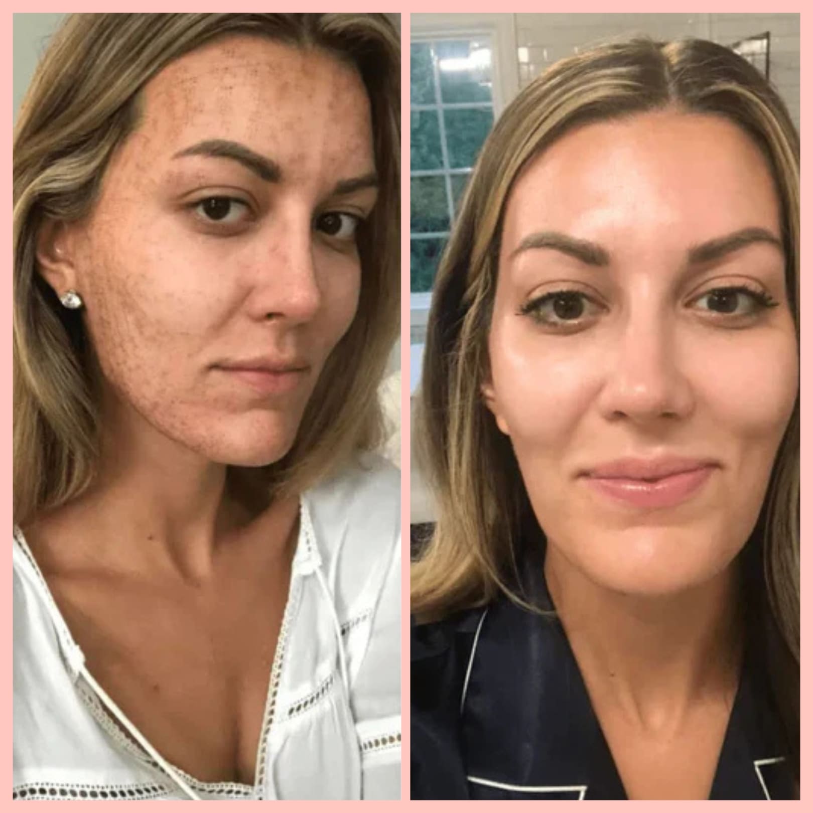 MIRAE GLOW – Masque de nuit au collagène